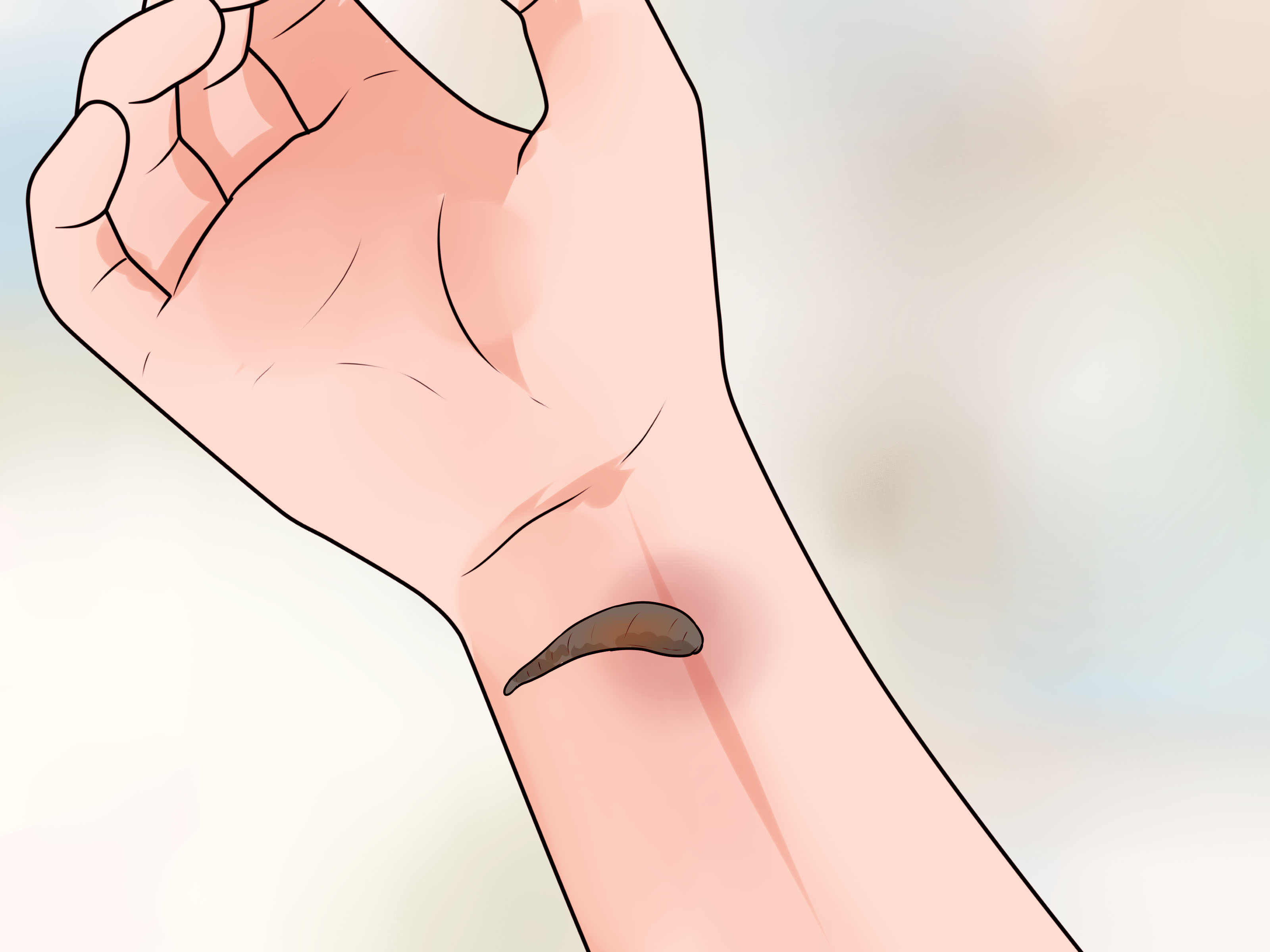 Arms clipart bruised.  simple ways to