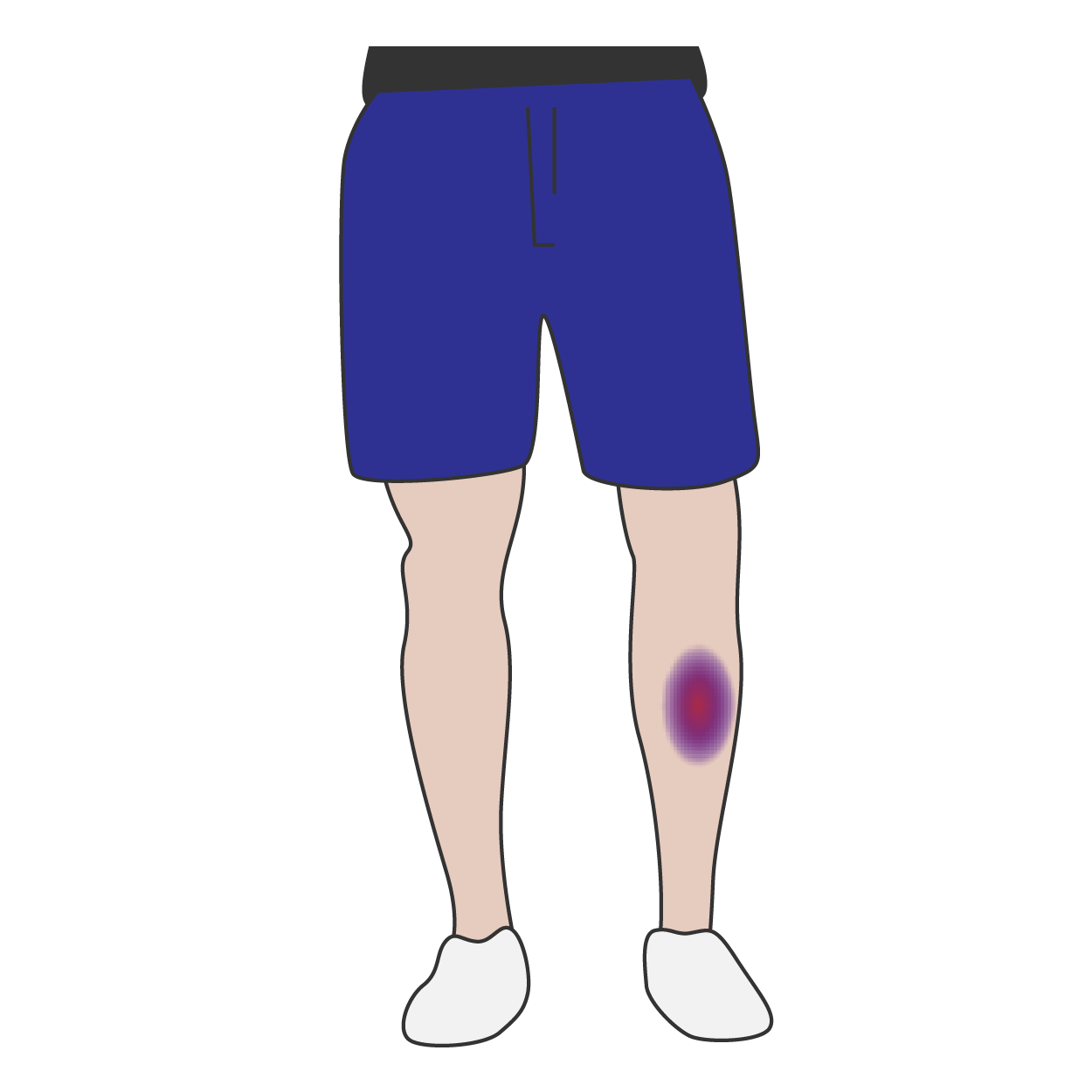 pain clipart bruised