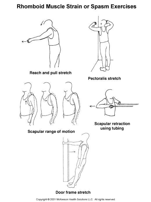 Rhomboid exercises sports medicine. Back clipart muscle spasm