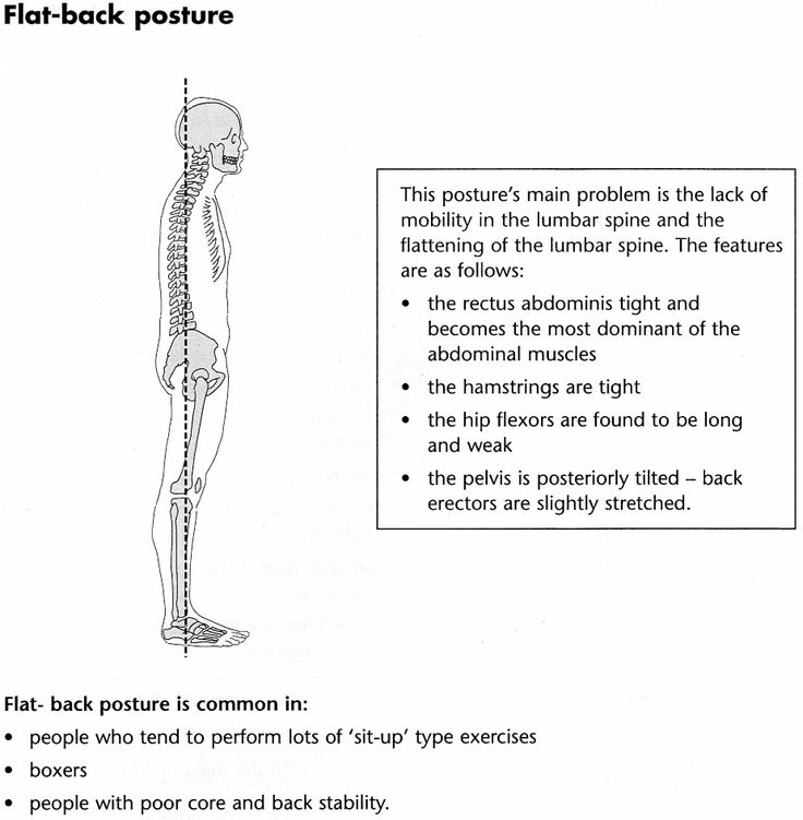 Back clipart muscle spasm.  best posture images