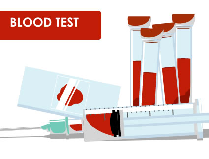 Private tests available to. Blood clipart blood work