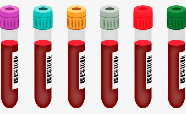 Tube human test png. Blood clipart blood work