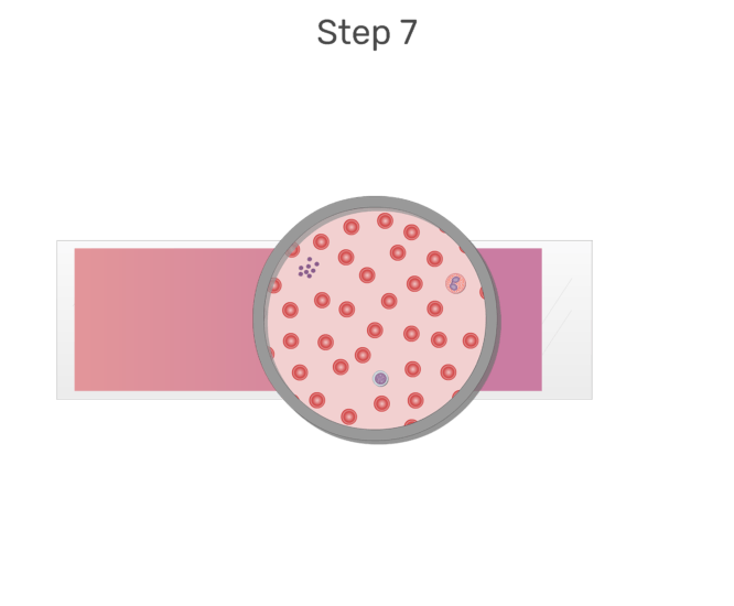 White cell differential test. Blood smear png