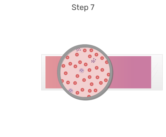 Blood smear png. White cell differential test