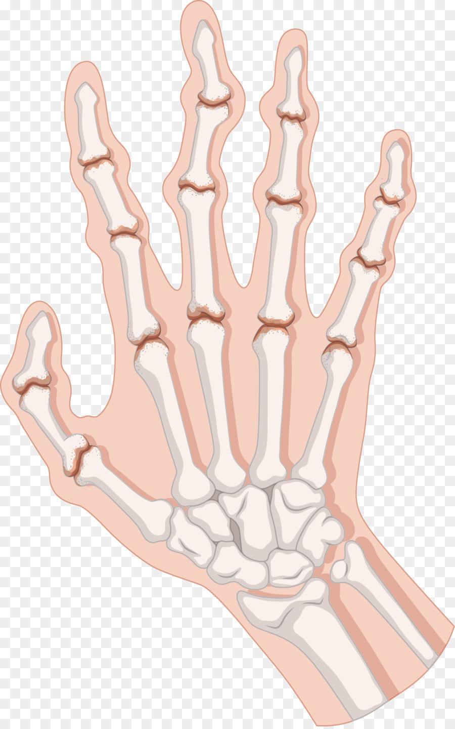 Rheumatoid arthritis clip art. Bone clipart body