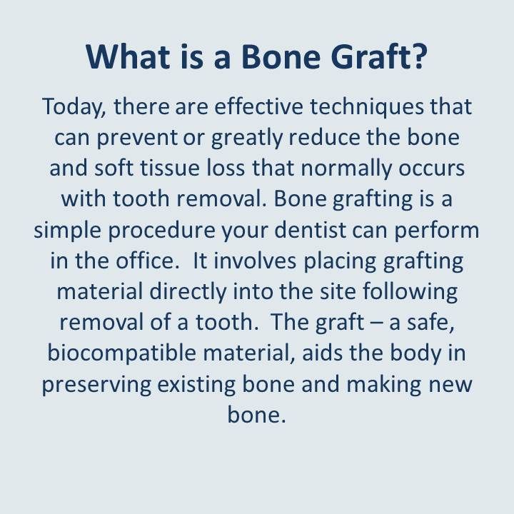 Bone clipart bone tooth.  best saving your