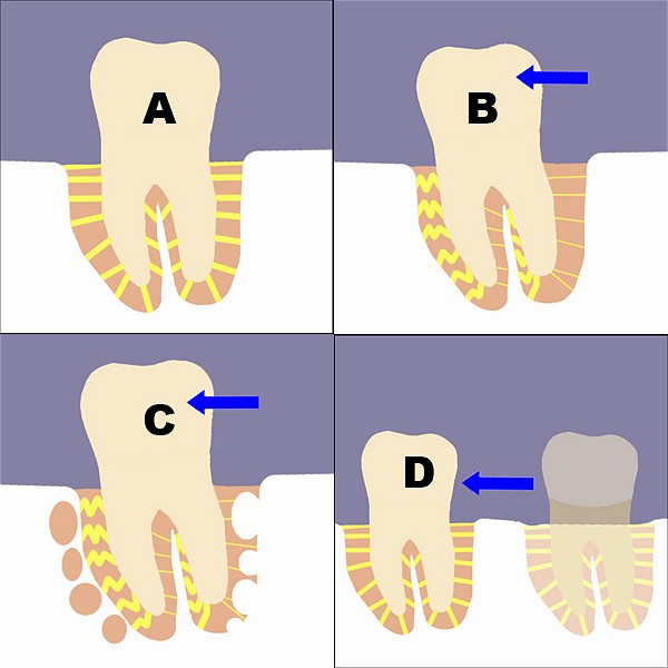 bones clipart bone tooth