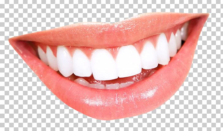 Smile human tooth png. Braces clipart cartoon mouth