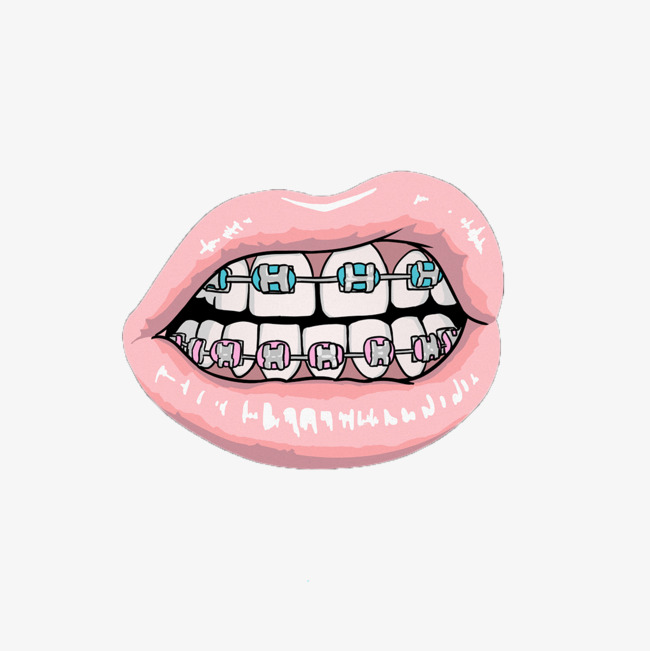Free creative lips to. Braces clipart cartoon mouth
