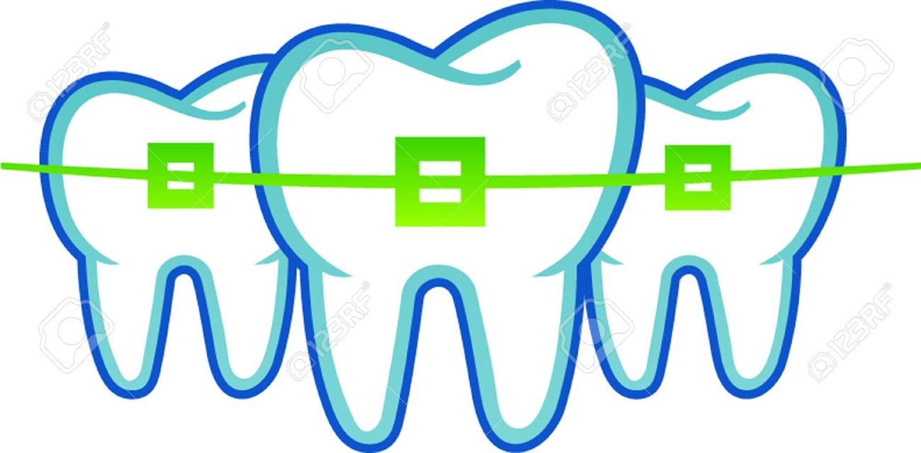Braces clipart cartoon mouth. Tooth with dental clip