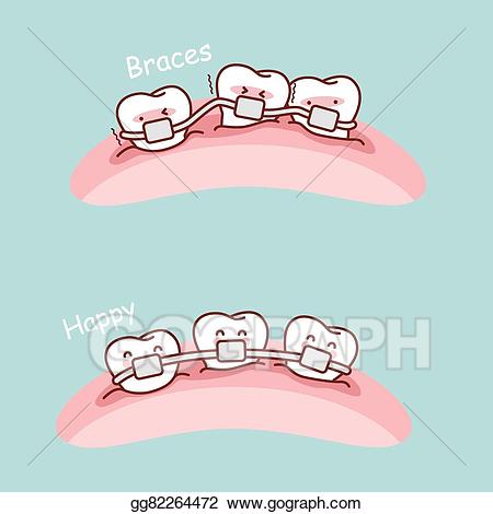 Braces clipart cute. Vector illustration cartoon tooth