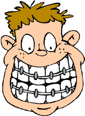 braces clipart dentist