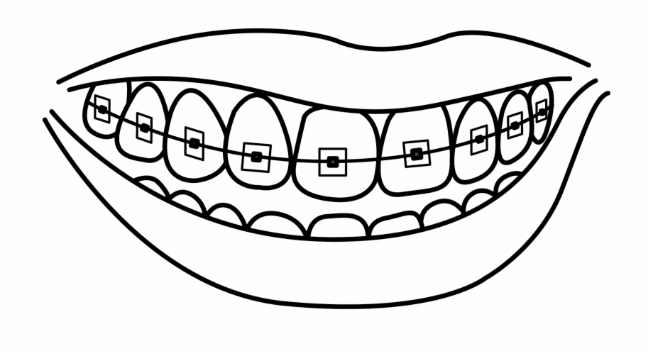 braces clipart draw