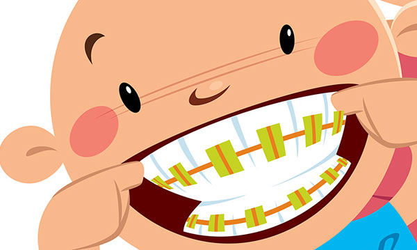 braces clipart kid tooth