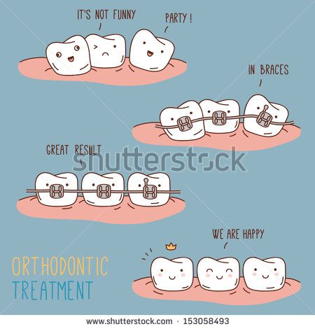 braces clipart orthodontic assistant