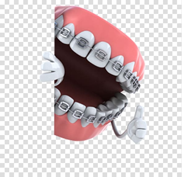 dental clipart orthodontist