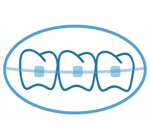 braces clipart orthodontist