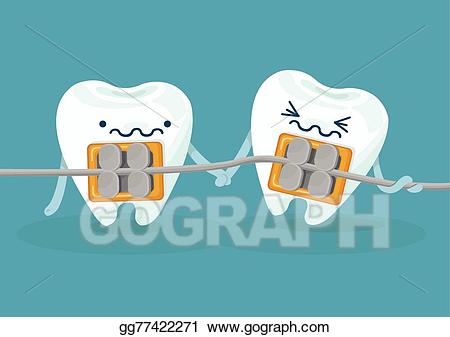 braces clipart vector