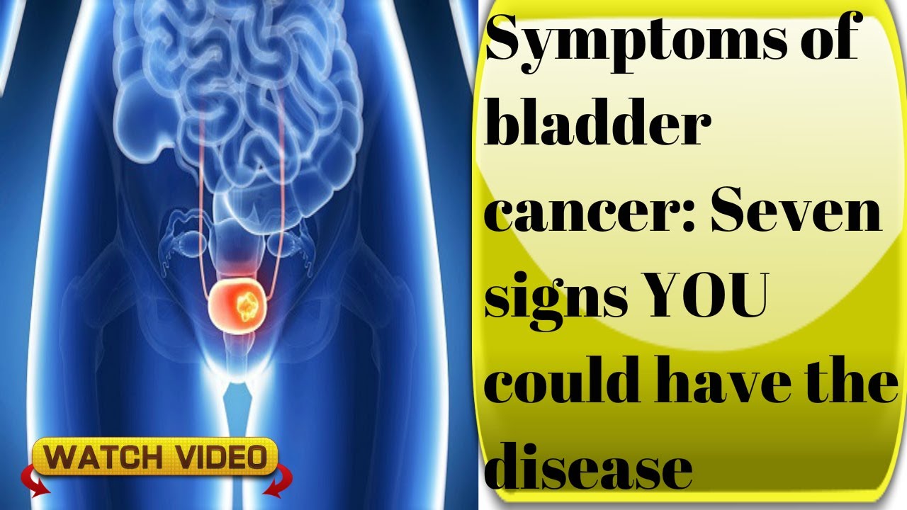 cancer clipart medical symptom