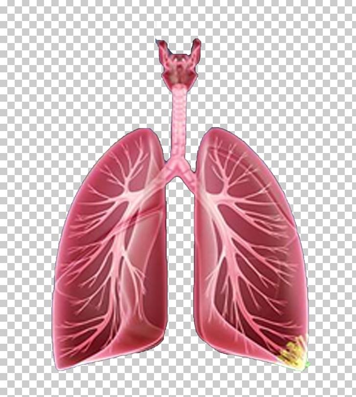 cancer clipart respiratory disease