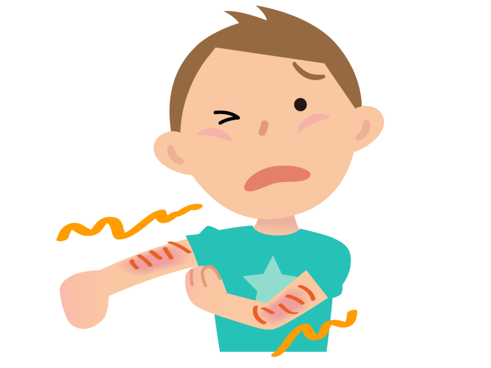 Allergic reaction three widsom. Clipart boy body