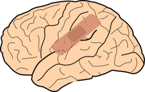 clipart brain concussion