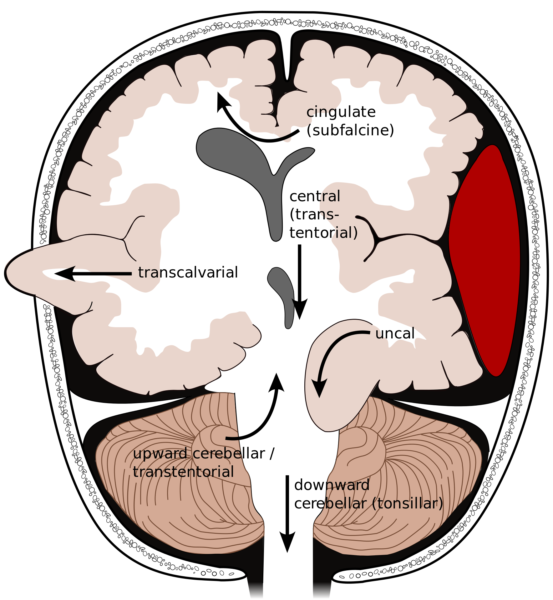 Knowledge clipart psychology brain. Types of herniation uncal