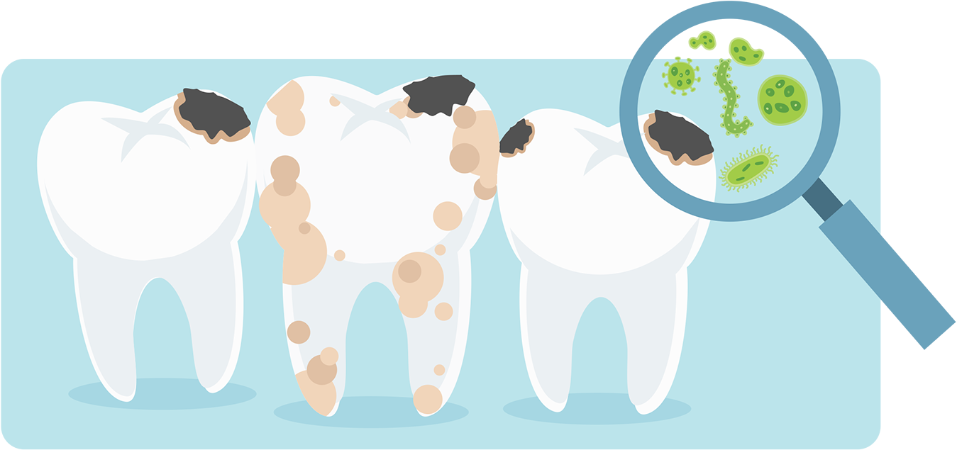 Clipart cow tooth. Guide to cavities taylor