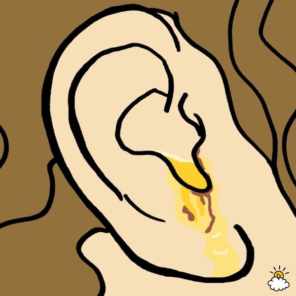 The color and texture. Ear clipart ear wax