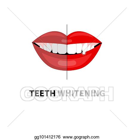 Vector stock teeth whitening. Clipart mouth beautiful tooth