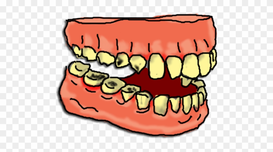 Clipart mouth gross. Decay rotten tooth clip