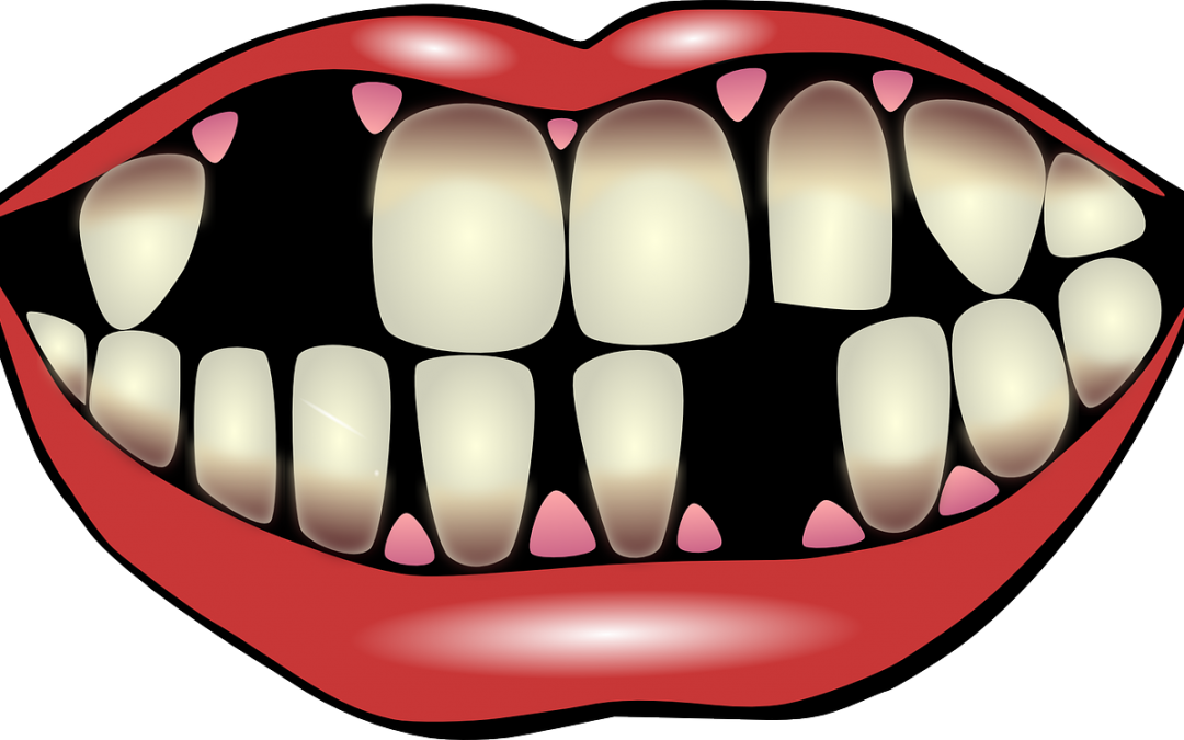 dentist clipart lost tooth