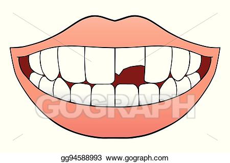 mouth clipart unhealthy tooth
