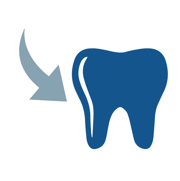clipart mouth unhealthy tooth