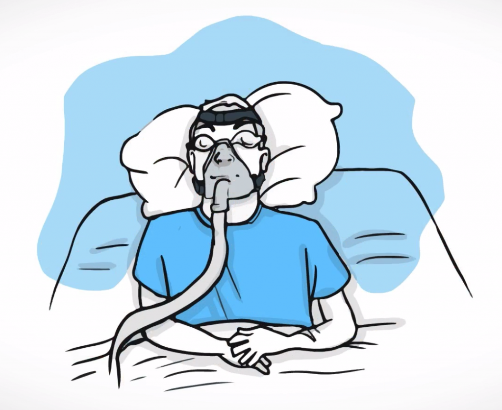Clipart sleeping sleep apnea. Eyes and 