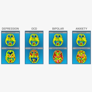 Brain vs normal . Communication clipart anxiety