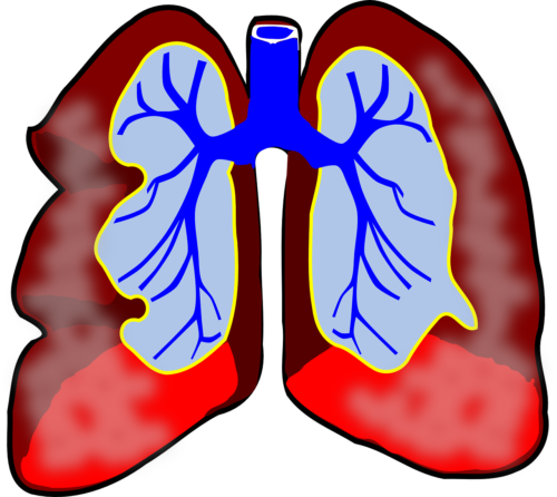 lungs clipart bronchitis