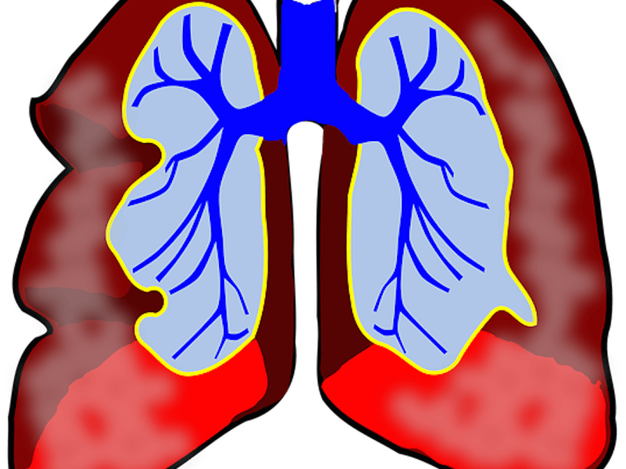 Allergic signs symptoms and. Lungs clipart asthma lung