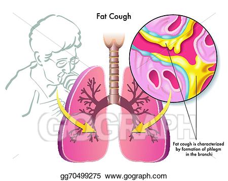 Cough clipart sputum. Vector art fat drawing