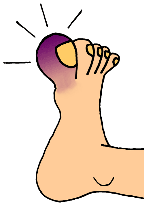 Pain foot pain