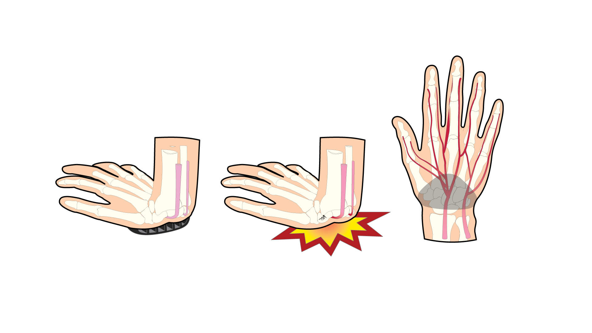 Skin hand palm