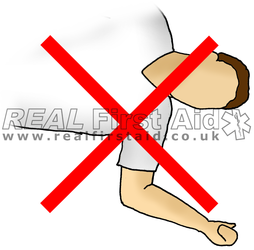Floor clipart unconscious man. Casualty positioning real first