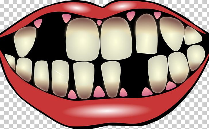 Dental clipart bad tooth. Implant dentistry png breath