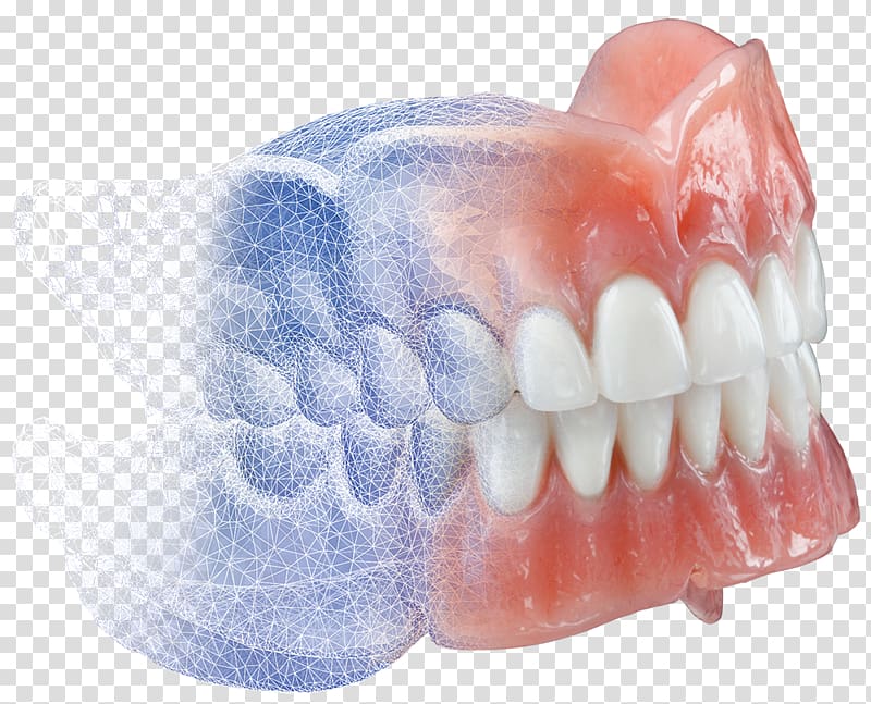Dental clipart dental lab. Dentures burdette cad cam