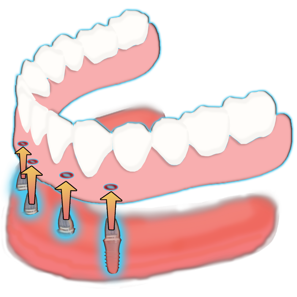 Dental clipart dentures. 
