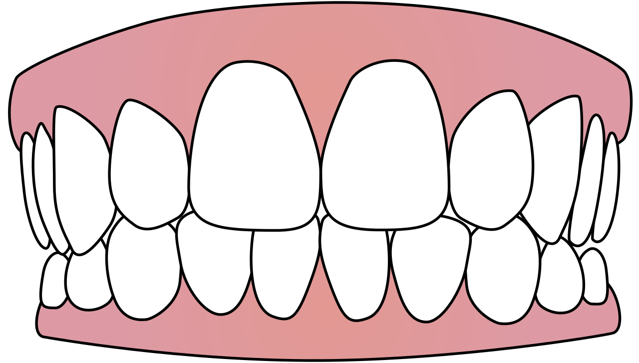 dental clipart dentures 889808. 