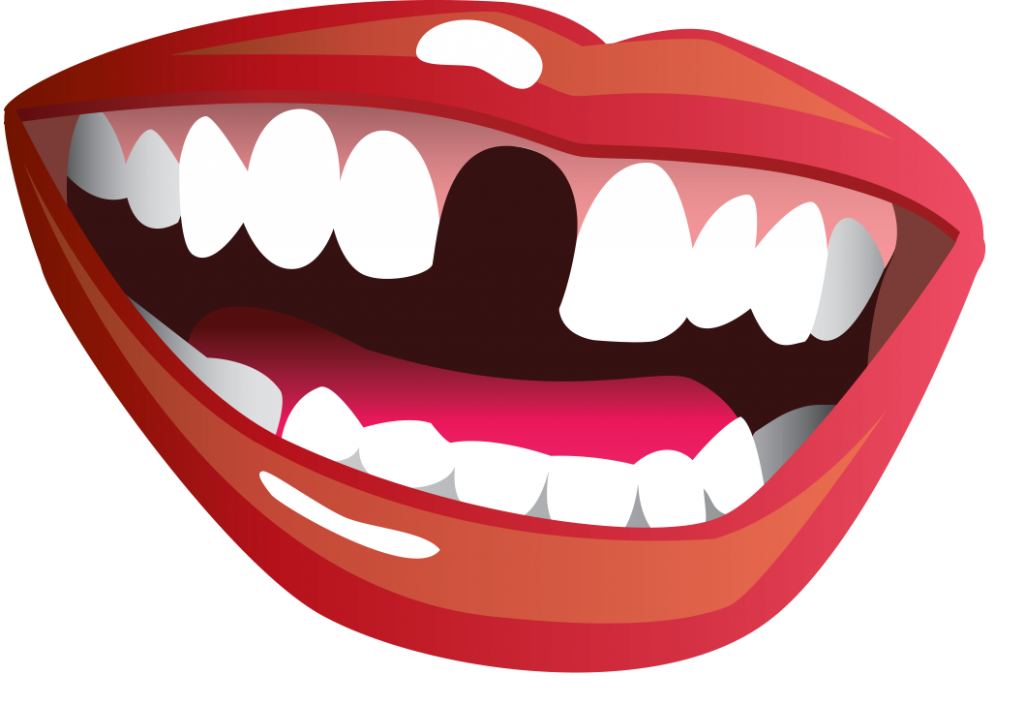 Does flossing really help. Dentist clipart lost tooth