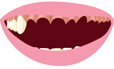 dental clipart lost tooth