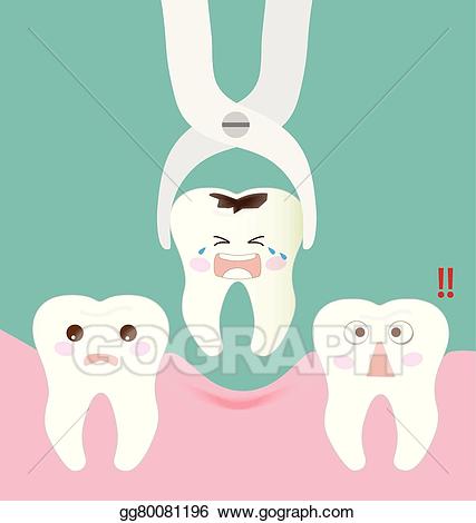 Eps vector forceps and. Dental clipart tooth extraction