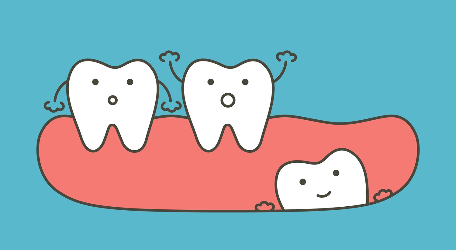 Wisdom teeth removal know. Dental clipart tooth extraction